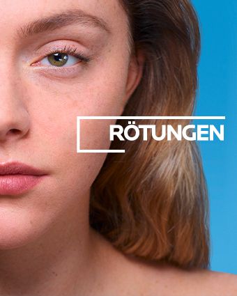 Rötungen